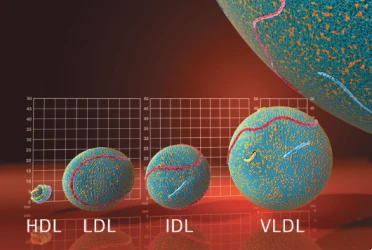 Lipids and Cardiovascular Risk