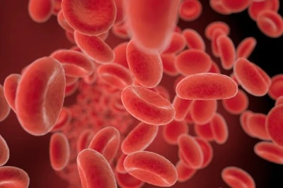 Methemoglobinemia Methemoglobinemia