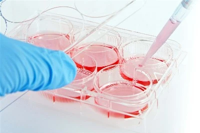 Cell culture Cell culture
