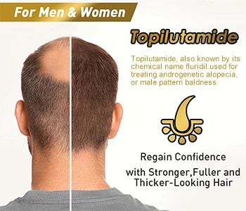 تسعة من كل عشرة رجال أصلع؟ كيفية منع وعلاج تساقط الشعر عند الرجال؟ افعلي 6 أش...