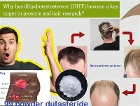 لماذا أصبح DHT هدفًا رئيسيًا في أبحاث البروستاتا والشعر