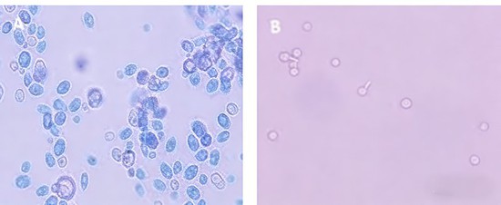 7199 powder Nystatin A 7199 powder Nystatin A