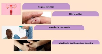 7199 powder Nystatin 7199 powder Nystatin